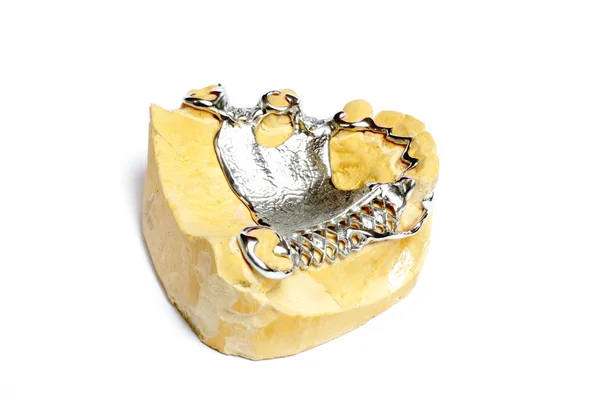Diş alçı kalıpları, protez — Stok fotoğraf