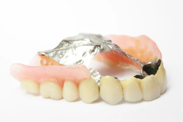 Zahnersatz, Prothesen Porzellan — Stockfoto