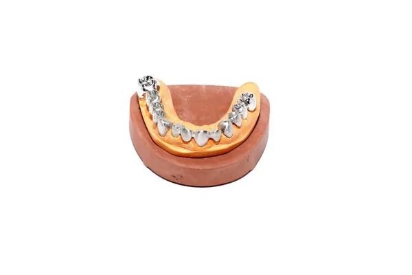 Moules en plâtre dentaire, prothèses dentaires — Photo