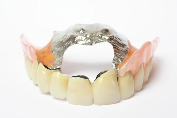 Dientes falsos (dentadura postiza, corona, puente ) — Foto de Stock