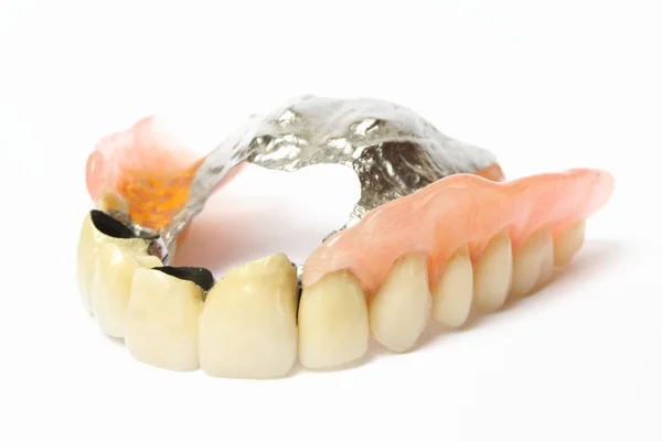 Dentes falsos (Dentura, Coroa, Ponte ) — Fotografia de Stock