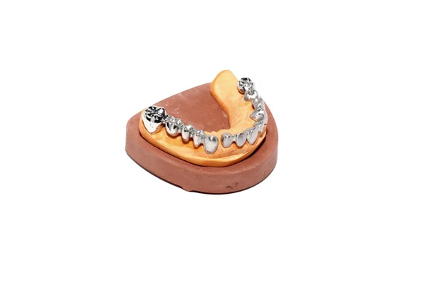 Dental plaster moulds, Dentures — Stock Photo, Image