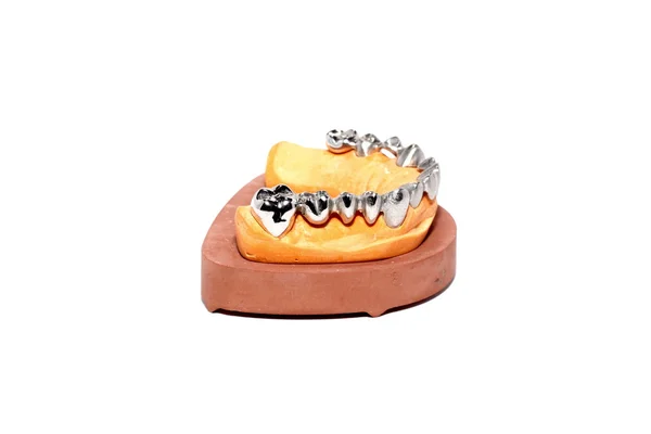Стоматологічна штукатурка прес-форми, зубні протези — стокове фото