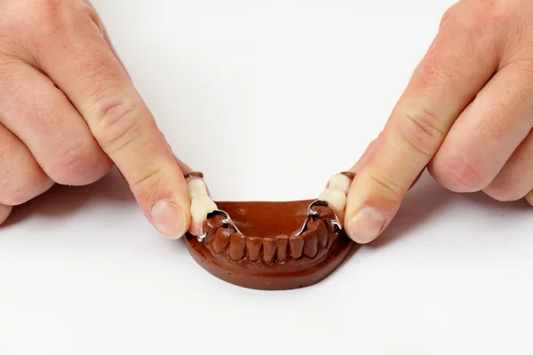 Montagem de modelo de gesso de mandíbulas artificiais — Fotografia de Stock
