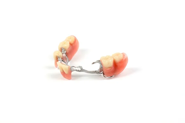 Hamis fogak (fogpótlás, korona, híd) — Stock Fotó