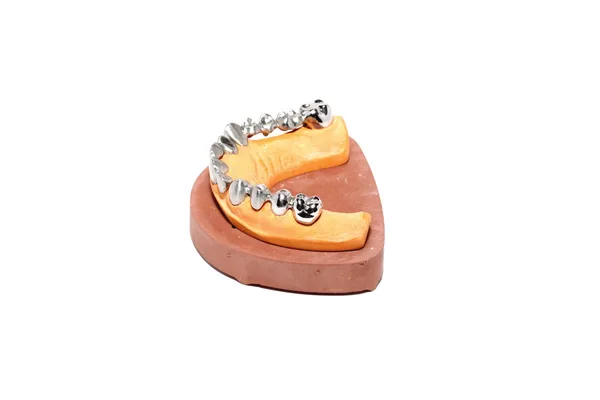Зубной гипс, зубные протезы — стоковое фото