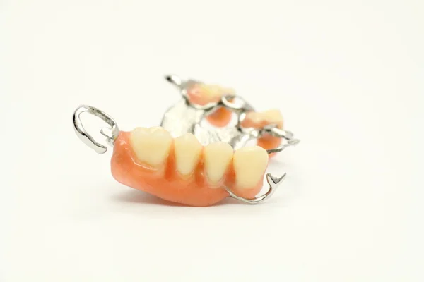 Вставні зуби (протез, Корона, міст) — стокове фото