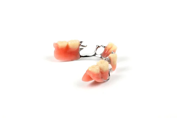 Falsche Zähne (Prothese, Krone, Brücke)) — Stockfoto