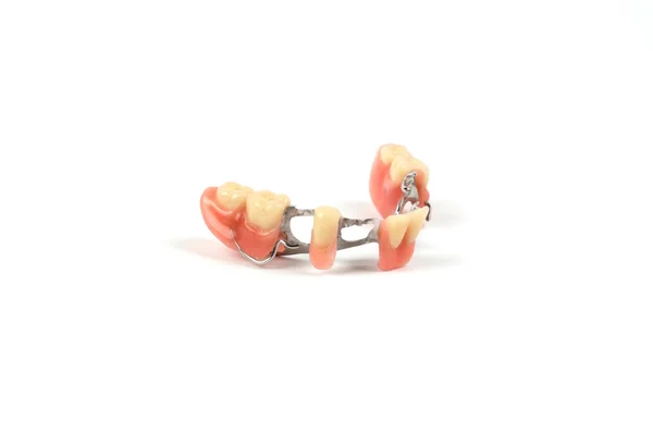 Falešné zuby (zubní protéza, koruny, most) ストックフォト