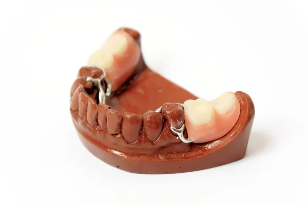 Moules en plâtre dentaire, prothèses dentaires — Photo