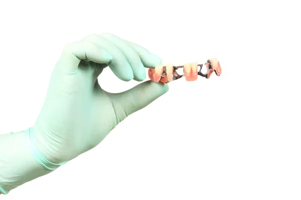 Zubní protézy na ruku — Stock fotografie