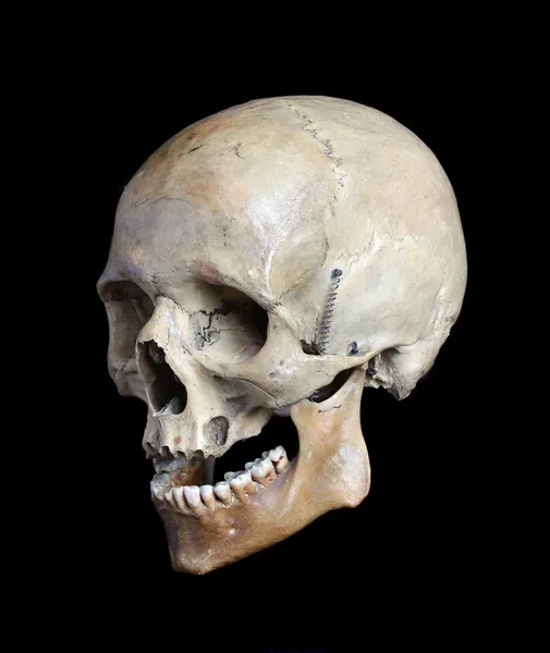 El cráneo de la persona — Foto de Stock