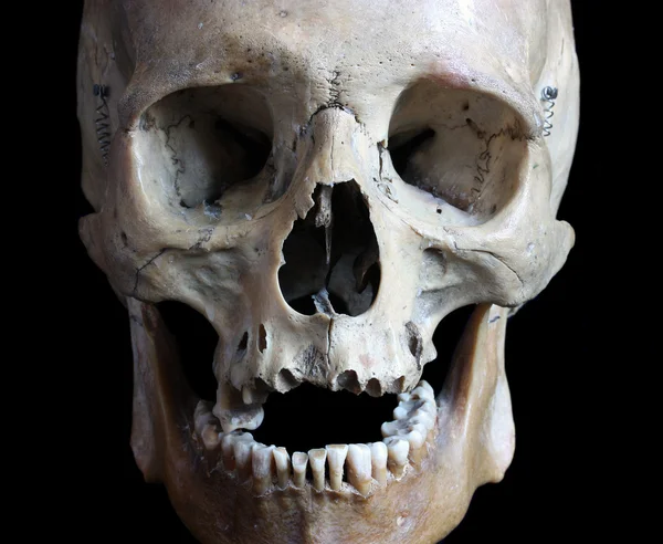 Crâne de la personne — Photo