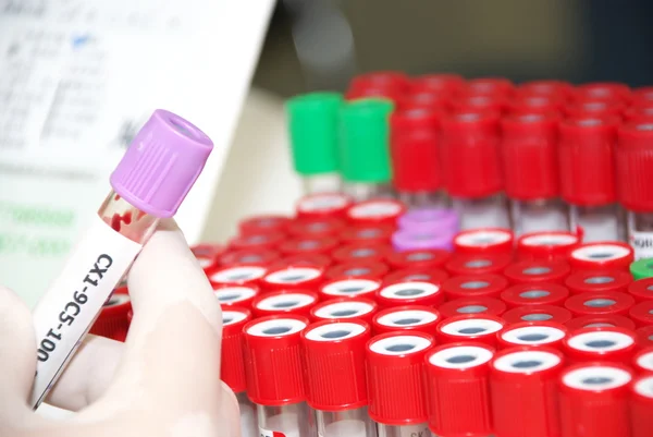 Blood test tube in hand — Stock Photo, Image