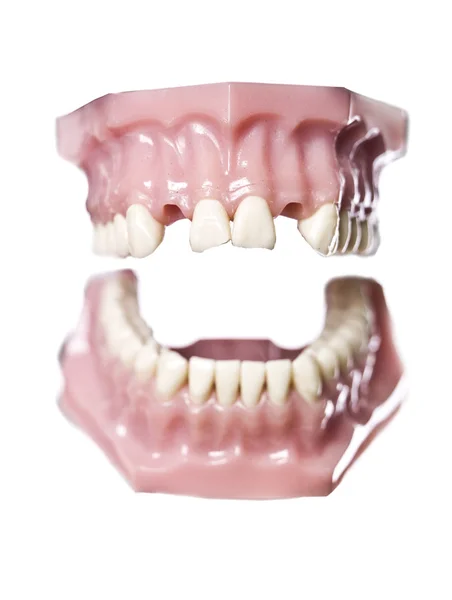 Vintage artificial teeths — Stock Photo, Image