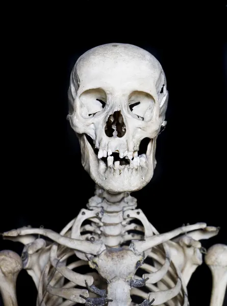 Kafatası — Stok fotoğraf