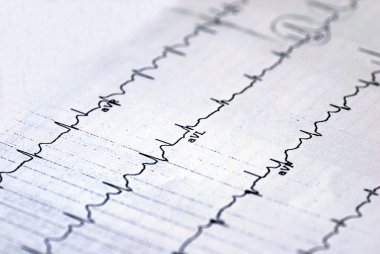 A macro picture of the EKG chart clipart