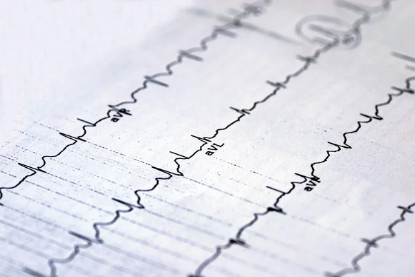 Uma imagem macro do gráfico EKG — Fotografia de Stock