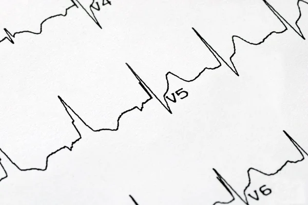 Uma imagem macro do gráfico EKG Fotos De Bancos De Imagens
