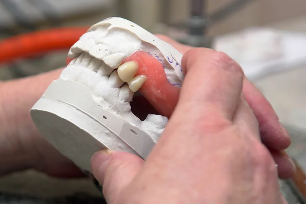 Зубний протез Стокове Фото