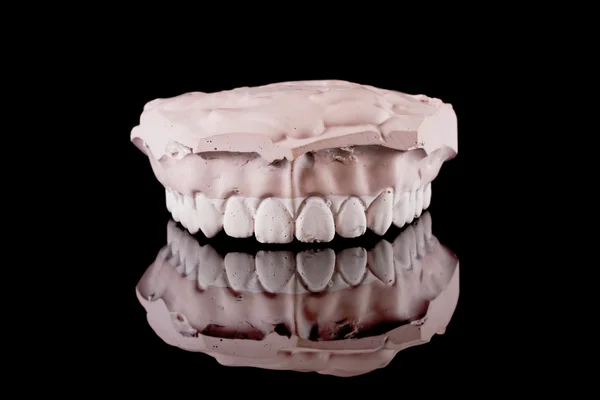 Ανθρώπινα δόντια, μοντέλο — Φωτογραφία Αρχείου