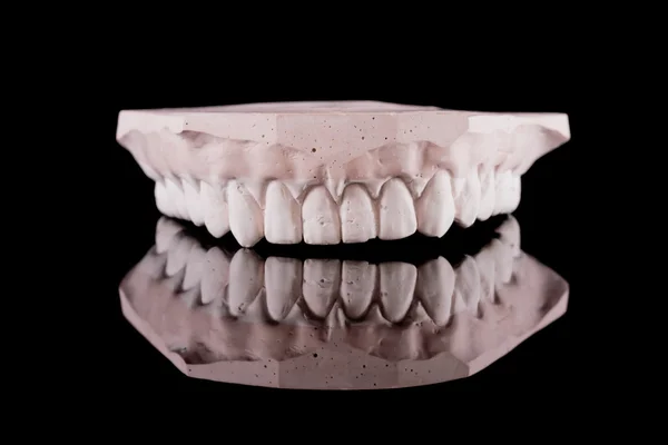 Lidské zuby, model — Stock fotografie