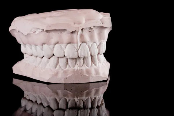 Dents humaines, modèle — Photo