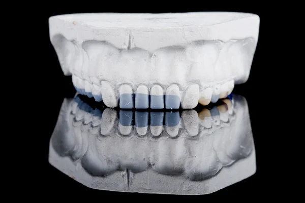 Denti umani, modello — Foto Stock