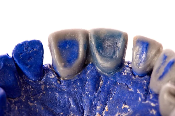 Ανθρώπινα δόντια, μοντέλο — Φωτογραφία Αρχείου