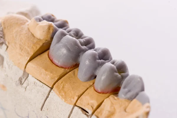 Denti umani, modello — Foto Stock