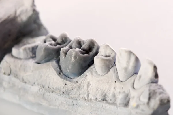 Emberi fogak, modell — Stock Fotó
