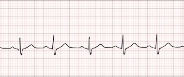 Electronic cardiogram illustration clipart