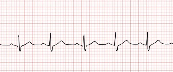 Электронная кардиограмма — стоковый вектор