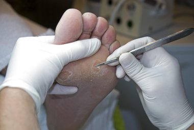 Pedicure removing hard skin. clipart