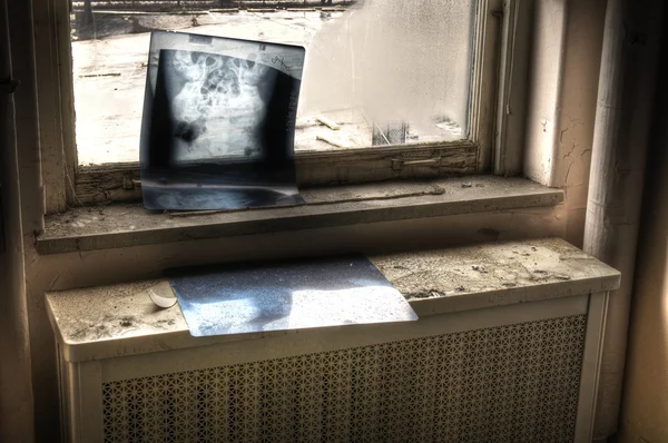 Röntgen i fönster — Stockfoto