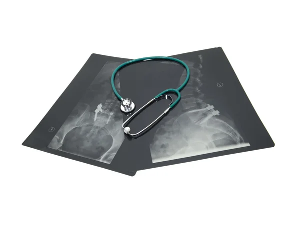 Radiografías consultar — Foto de Stock