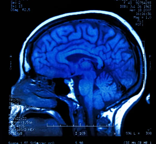 Hersen-MRI voldoet — Stockfoto