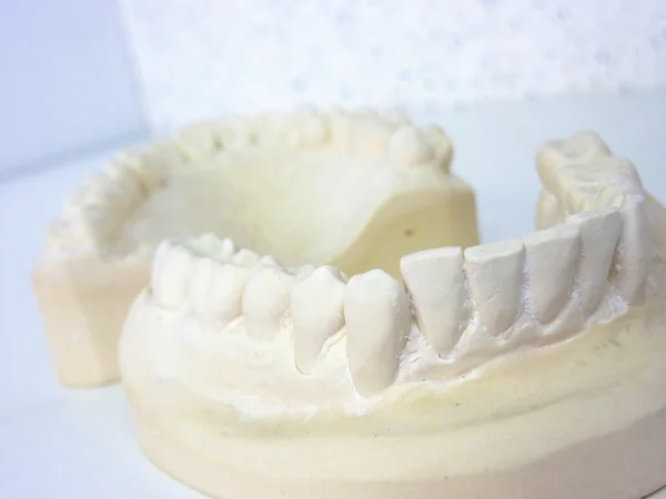 Plaster teeth — Stock Photo, Image