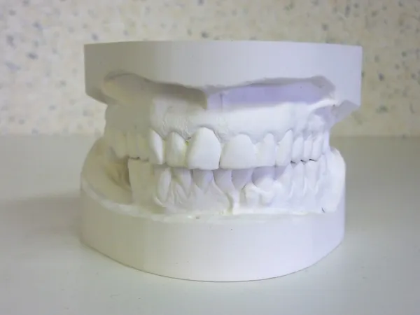 White plaster mouth — Stock Photo, Image
