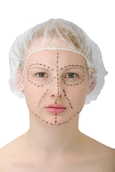 Woman before plastic surgery — Stock Photo, Image