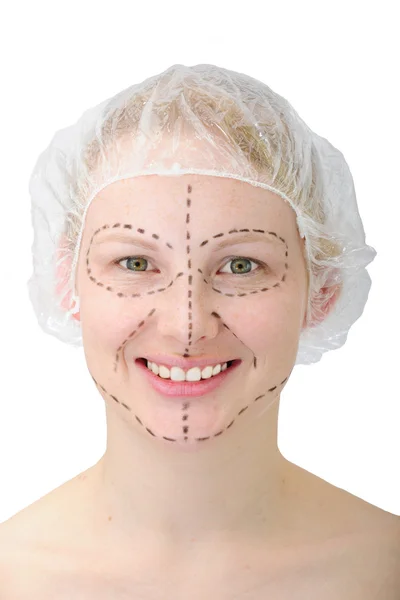 Cirurgia plástica / lifting facial — Fotografia de Stock