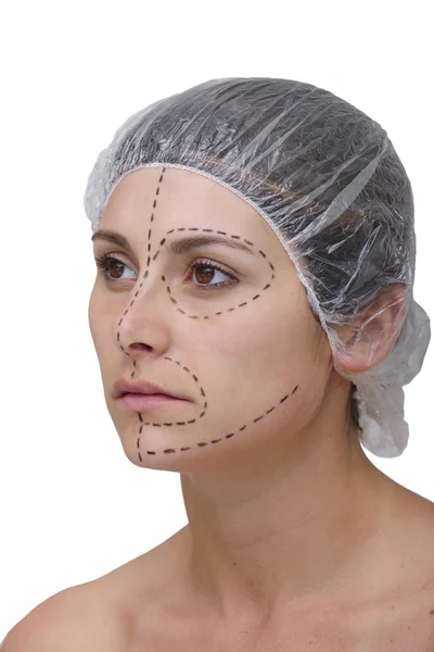 stock image Woman before plastic surgery