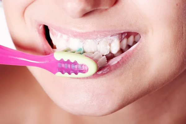 Kein Zahnarzt — Stockfoto