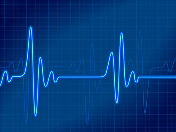 Cardiogramme bleu — Image vectorielle