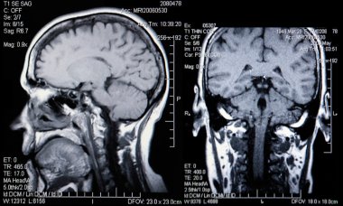 Real MRI Scans of the Head and Brain clipart