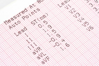 Cardiographical test results clipart