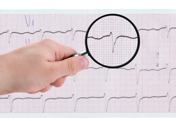 Bližší pohled na EKG výtisk — Stock fotografie