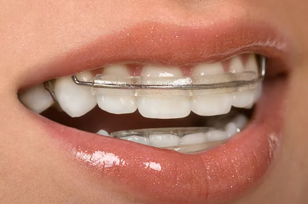 Diş ParçalarıComment — Stok fotoğraf