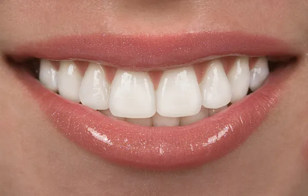 牙齿 — 图库照片