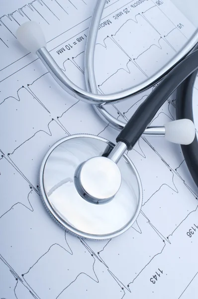 Närbild av en stetoscope och EKG — Stockfoto